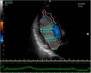 Vector Flow Mapping (VFM) to narzędzie do kwantyfikacj