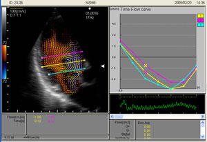 Vector Flow Mapping (VFM) to narzędzie do kwantyfikacj