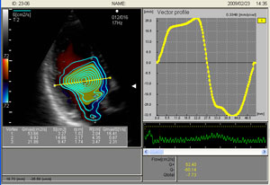 Vector Flow Mapping (VFM) to narzędzie do kwantyfikacj