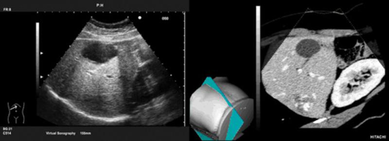 Ultrasonografia wirtualna w czasie rzeczywistym